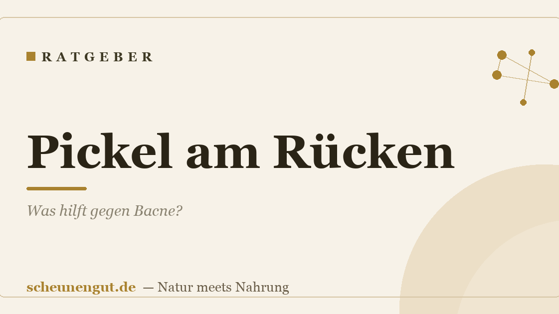 Pickel am Rücken: Was hilft gegen Bacne?