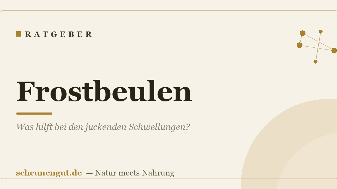 Frostbeulen: Was hilft bei den juckenden Schwellungen?