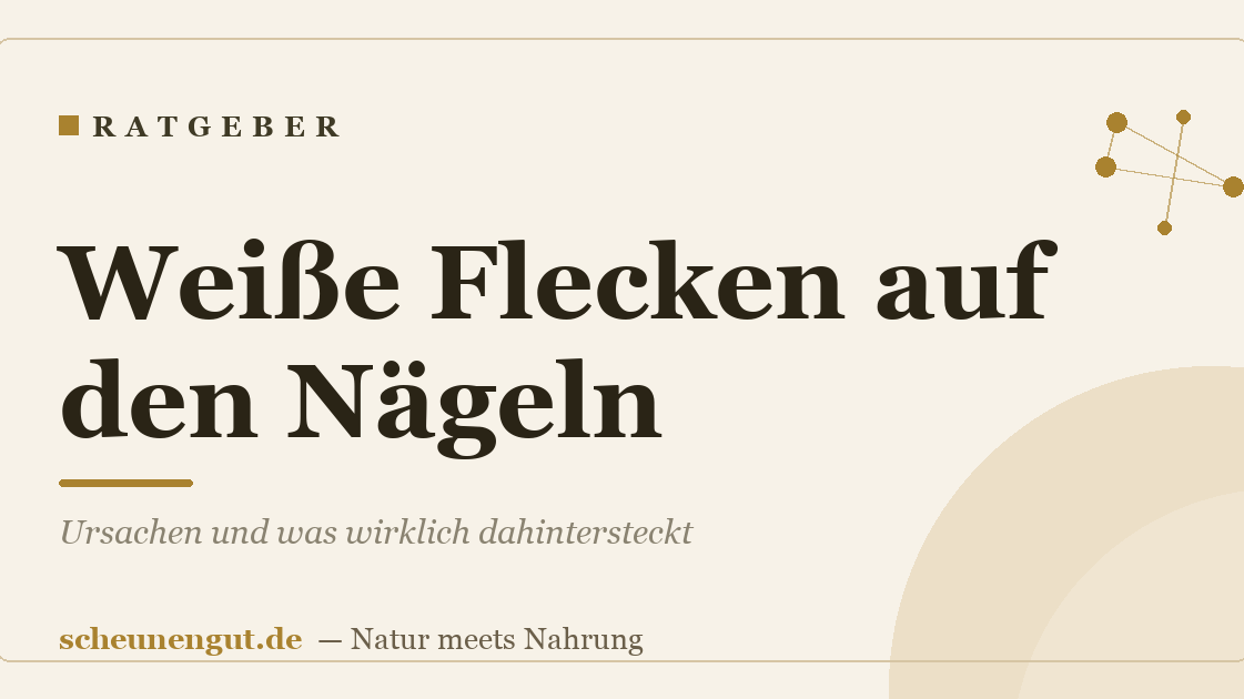 Weiße Flecken auf den Nägeln: Ursachen und was wirklich dahintersteckt