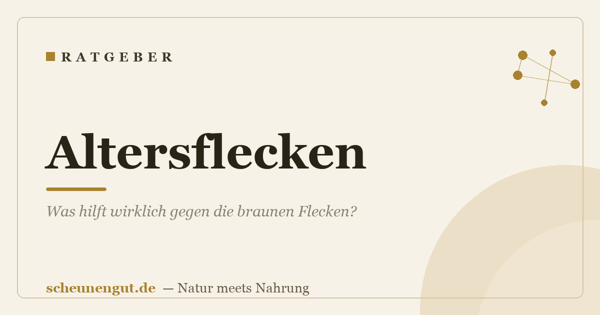 Altersflecken: Was hilft wirklich gegen die braunen Flecken?