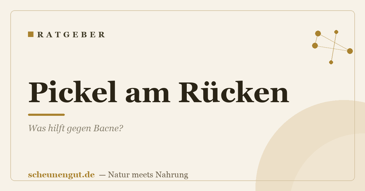 Pickel am Rücken: Was hilft gegen Bacne?