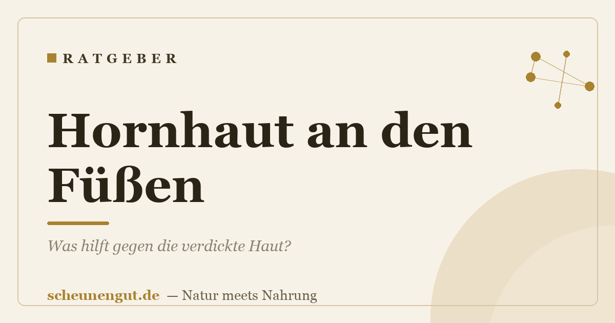 Hornhaut an den Füßen: Was hilft gegen die verdickte Haut?