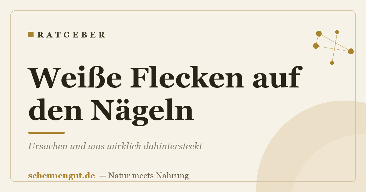 Weiße Flecken auf den Nägeln: Ursachen und was wirklich dahintersteckt